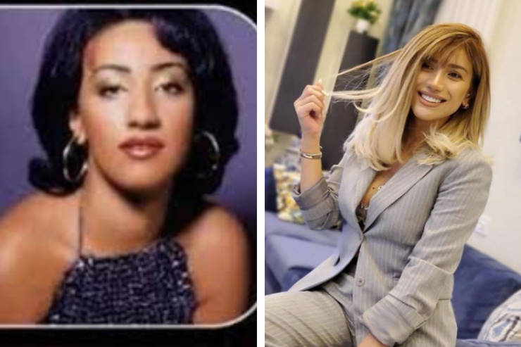 Röya Ayxan əməliyyat etdirəcək: "Hər gün əziyyət çəkirəm" 