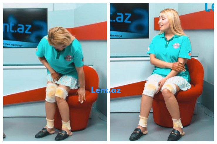 Barda partlayışda yaralanan qız danışdı: "Tərbiyəsizsiz"  - VİDEO  