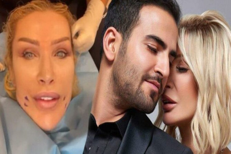 Bu yaxınlarda  toyu olacaq  müğənni BƏDƏNİNİ İNCƏLTDİ