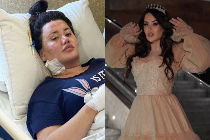 Klubda partlayışda yaralanan Aysel: "Allah qohumlarımın bəlasını versin" 