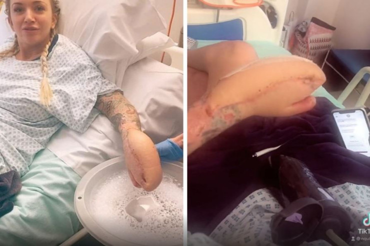 Bu qadının qolu balinanın başına  bənzəyir