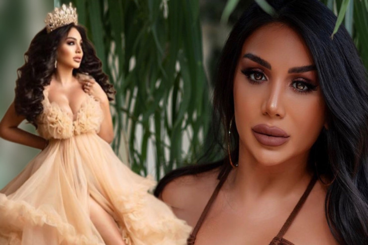 Həmkarları özünü ona oxşadır - Azərbaycanlı müğənnidən İDDİA 