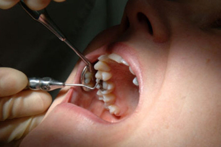 Qadın həkimi gözləməkdən bezdi  - 13 DİŞİNİ ÖZÜ ÇƏKDİ 