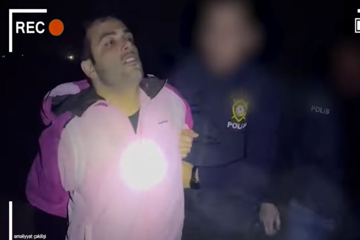 Əməliyyat görüntüsü