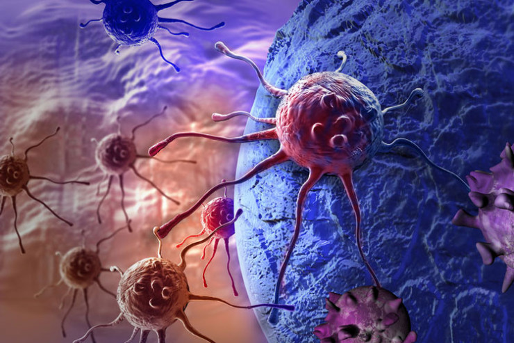 Sümük iliyi xərçəngi belə müalicə olunacaq