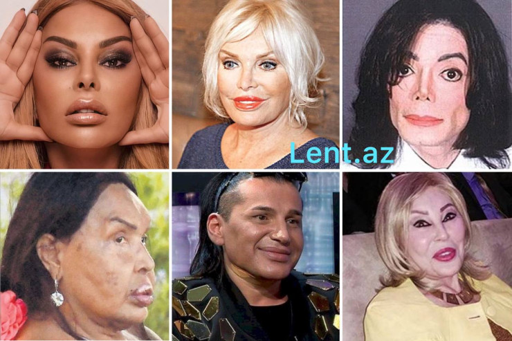 Dəfərlərlə estetik əməliyyat etdirən, tanınmaz hala düşən MƏŞHURLAR  - SİYAHI 