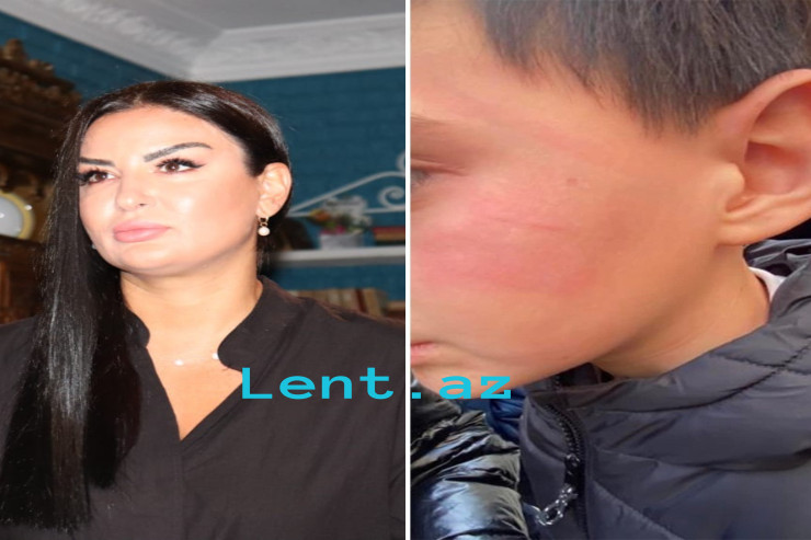 Tanınmış teleaparıcı məktəbdə döyülmə faktından danışdı - RƏSMİ REAKSİYA 