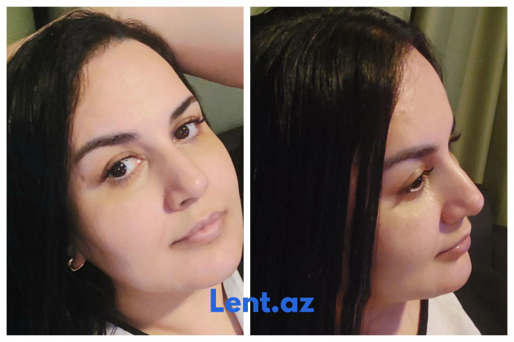 Azərbaycanlı müğənni koronavirusa yoluxub -  FOTOLAR 