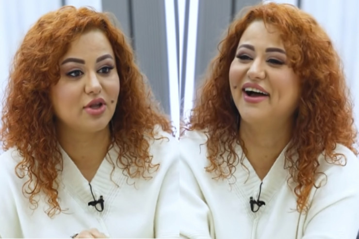 46 yaşlı Əməkdar artist plastik əməliyyat etdirdi