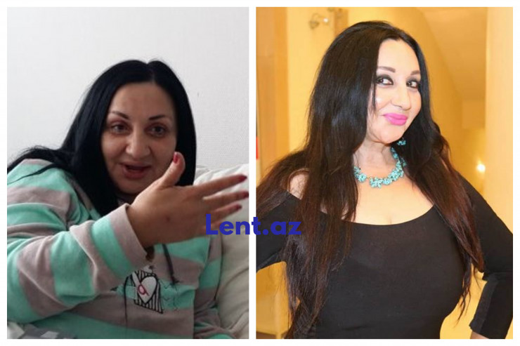 58 yaşlı Xalq artistimiz SİNƏSİNİ KİÇİLDƏCƏK 