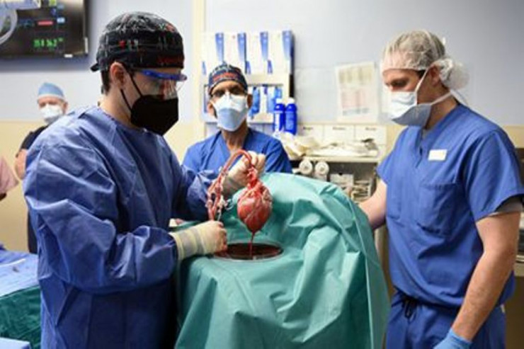 İnsana donuz ürəyi   köçürüldü: DÜNYADA İLK - VİDEO 