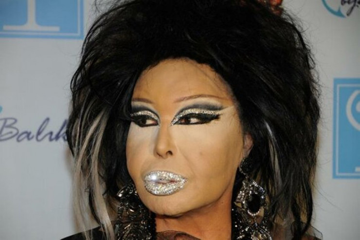 Bülent Ərsoya görə  KOMANDİR   işdən çıxarıldı - FOTO 