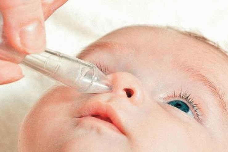 Bakıda 3 yaşlı uşağın burnundan çıxan həkimi ŞOKA SALDI  - FOTO 