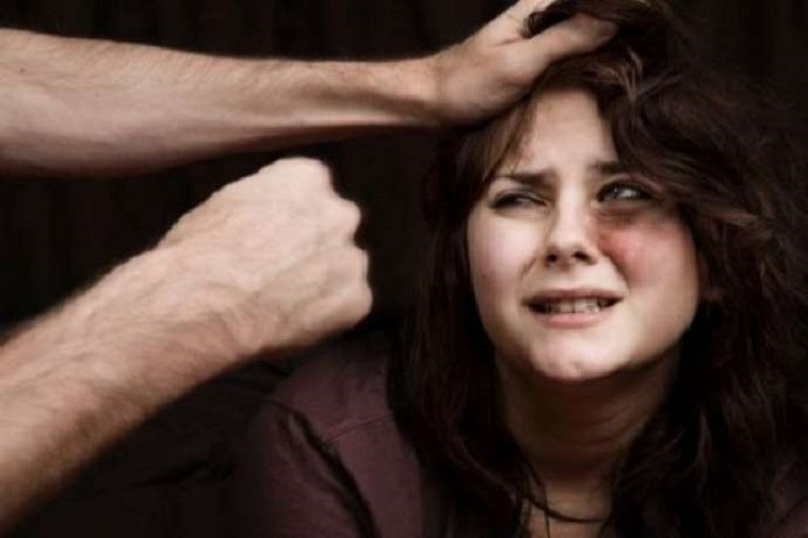 Azərbaycanda  iki qadını döyüb   evdən qovdular -  FOTO 