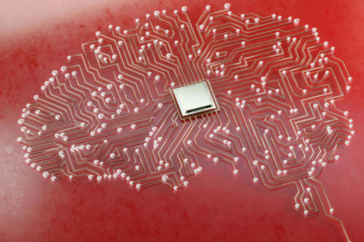 İnsan beyninə daimi İMPLANT  yeridildi