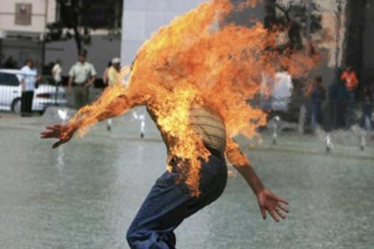 Bakıda kişi yaşadığı evdə ÖZÜNÜ YANDIRDI 