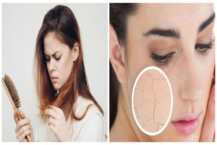 Fəsil dəyişəndə saçlarınız tökülür, dəriniz quruyur? – Diqqətlə OXUYUN  