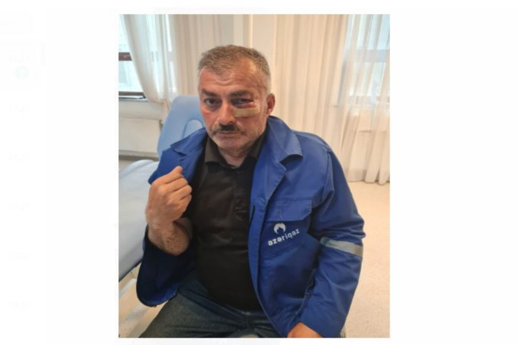 "Azəriqaz"ın əməkdaşını döyənə cinayət işi açıldı - YENİLƏNİB 