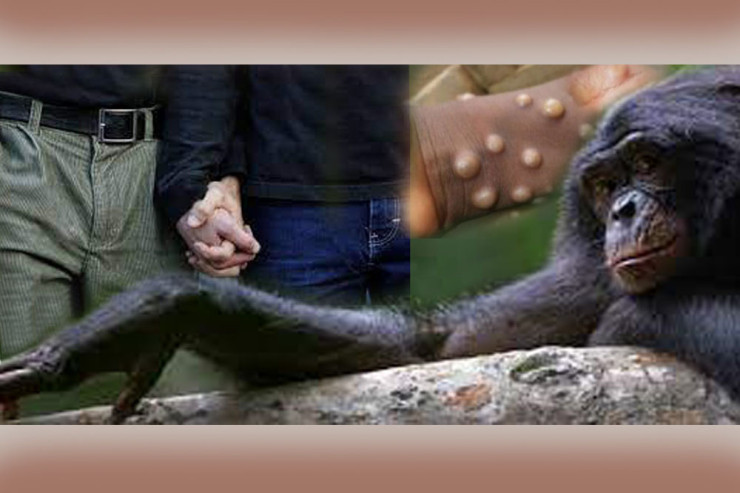 “Meymun çiçəyi”:  Hədəfdə geylər və biseksuallar...