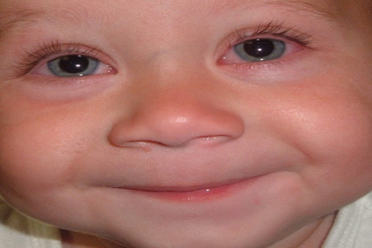 DİQQƏT!  Uşaqlar arasında YENİ VİRUS : gözləri, qulaqları...