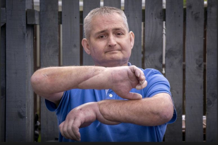 TARİXDƏ İLK:  Xəstəyə əl köçürüldü