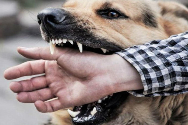 Bakıda 321 nəfəri İT DİŞLƏYİB  - RƏSMİ