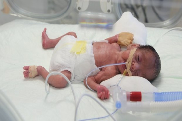 Evdə erkən doğulan körpələrə necə baxılmalıdır? - MÜSAHİBƏ 