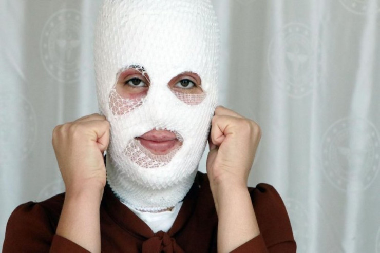 Mərcimək bişirdi, qazan  PARTLADI   - 16 yaşlı qızın üzü...