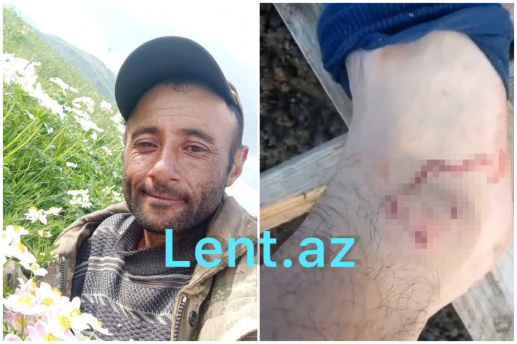 Bu gün yaralanan iki mülki şəxsdən biri şairdir