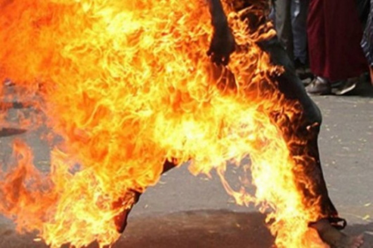 Bakıda  özünü yandıran   oğlan öldü - FOTO 