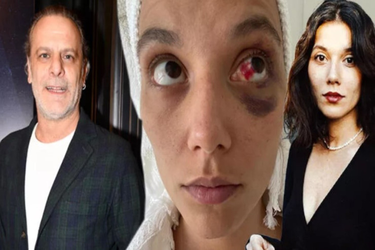 Sevgilisini döydüyü deyilən aktyor  DANIŞDI:  "Az qaldı..."