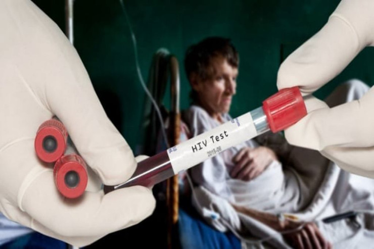 Azərbaycanda qeydiyyatda olan QİÇS xəstələrinin  SAYI  