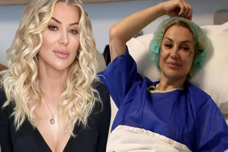 Məşhur müğənni  estetik əməliyyatla   20 il cavanlaşdı