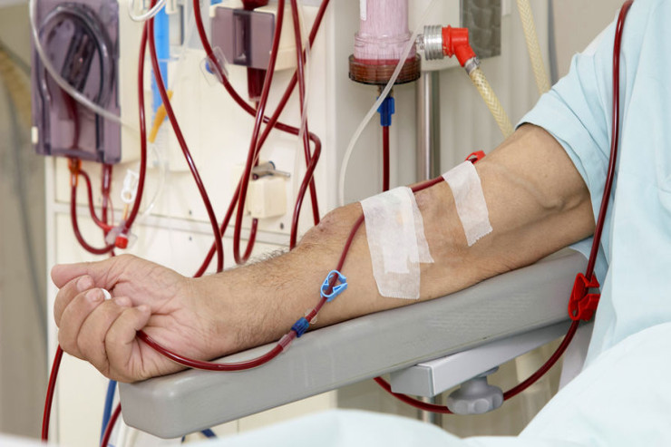 Böyrək çatışmazlığının qarşısını almağın yolları tapıldı