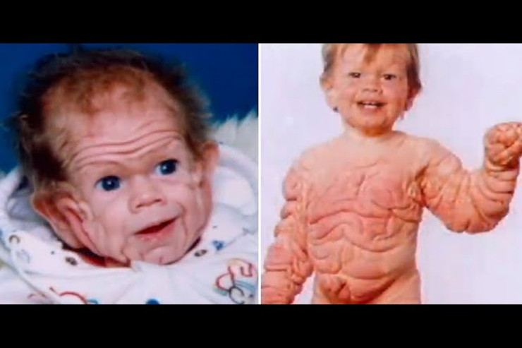 Qoca doğulan körpənin görüntüləri şoka saldı 