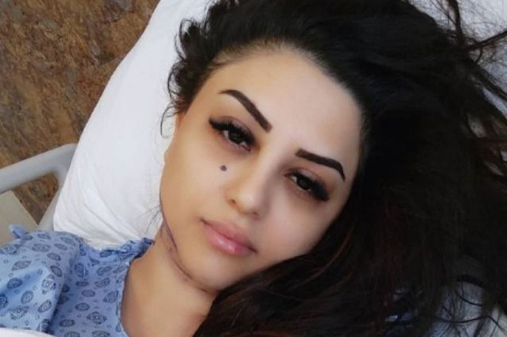 Tanınmış aktrisa plastik əməliyyatdan sonra