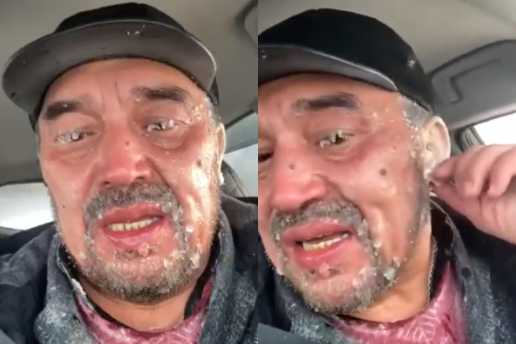 50 dərəcə şaxtadan sağ çıxdı –  Qulaqları və kirpikləri dondu  