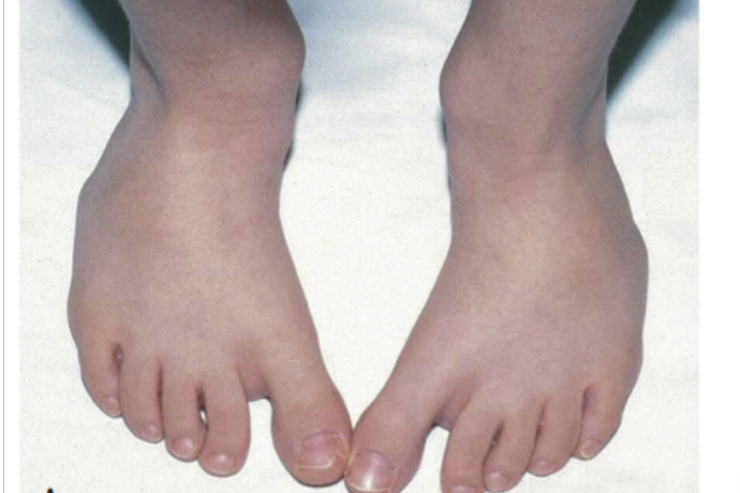 Özünüz də bilmədən yerişiniz dəyişib? – SƏBƏBİ AÇIQLANDI 