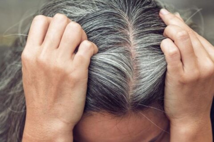 Ağarmış saçları qoparmağın CİDDİ TƏHLÜKƏLƏRİ 