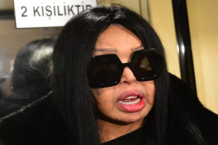 Bülent Ersoy onu təhqir edən kafe sahibini  MƏHKƏMƏYƏ VERDİ  - FOTO 