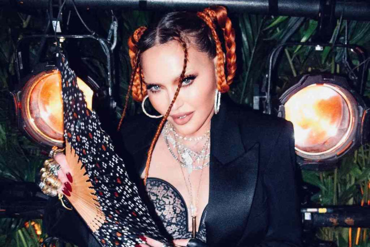 Madonna əməliyyatdan sonra üzünü GÖSTƏRDİ  - FOTO 