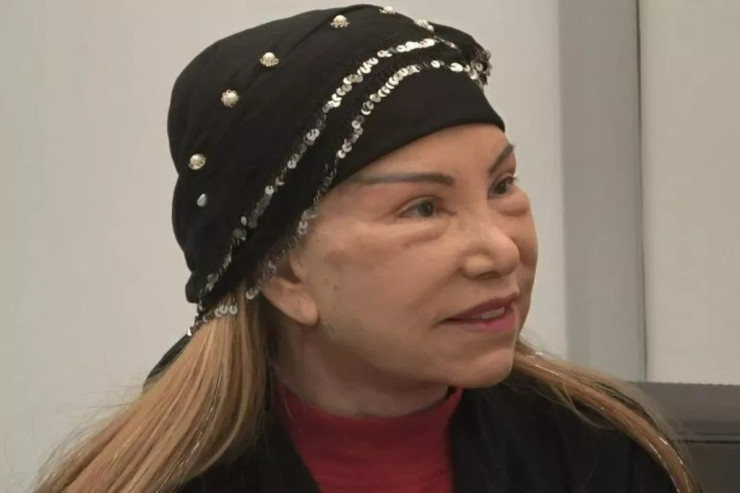 Estetik etdirən  81 yaşlı ifaçıdan   tənqidlərə CAVAB