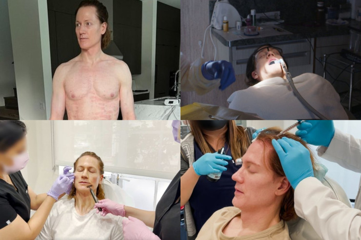 Milyonçu 18 yaşında görünmək üçün hər il 2 milyon XƏRCLƏYİR 