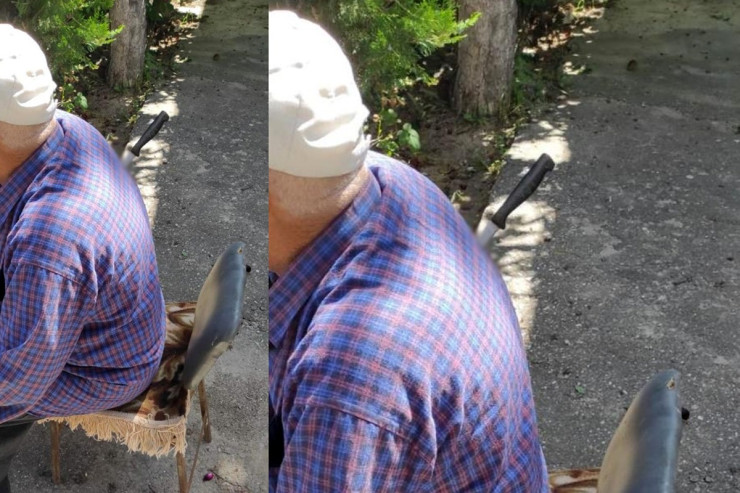 Kürəyindəki bıçaqla  küçədə oturub həkimləri gözlədi