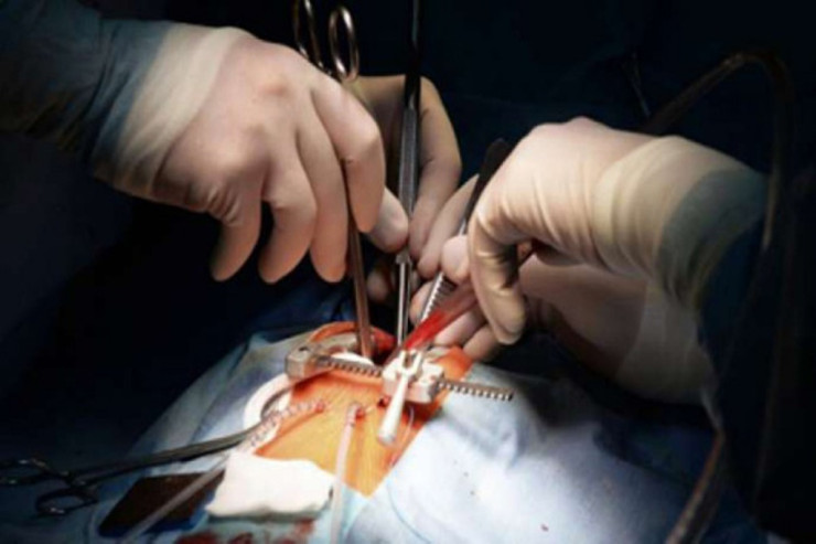 16 min ürək əməliyyatı edən həkim infarktdan öldü