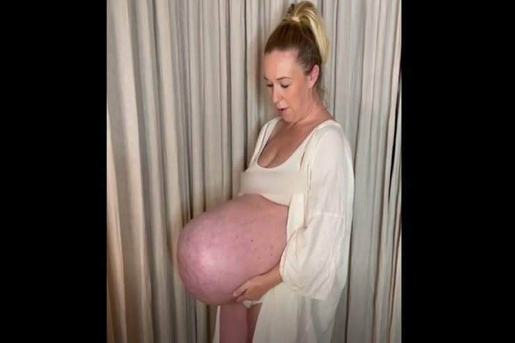 Üçəmlərə hamilə olan qadının qarnı  görənləri şoka saldı 