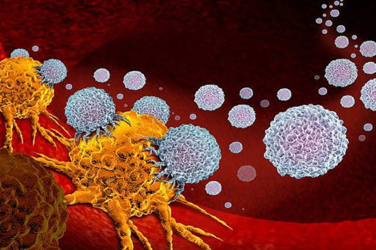 Gündə 5 dəqiqə yetər, xərçəng riskini  AZALDIR 