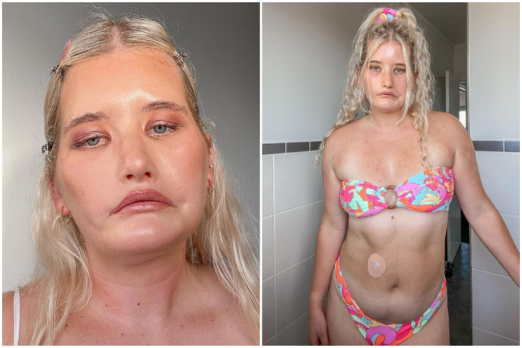 Bu qız ömrü boyu bir dəfə də gülümsəməyib