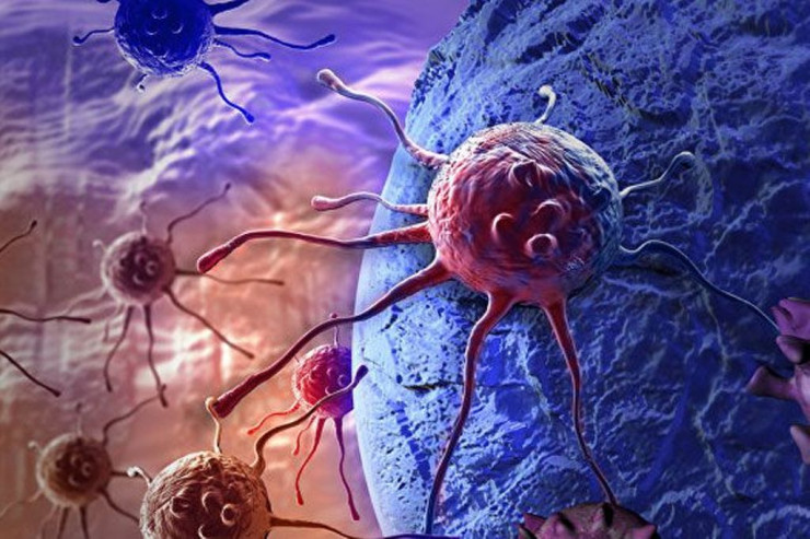 Onkoloqdan qadınlara müraciət: "Həkimə gəlməkdə gecikməyin"