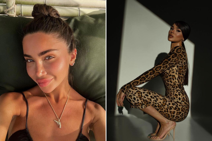 Bakıda tanınmış influenserlərin başına şüşə atıldı-FOTO 